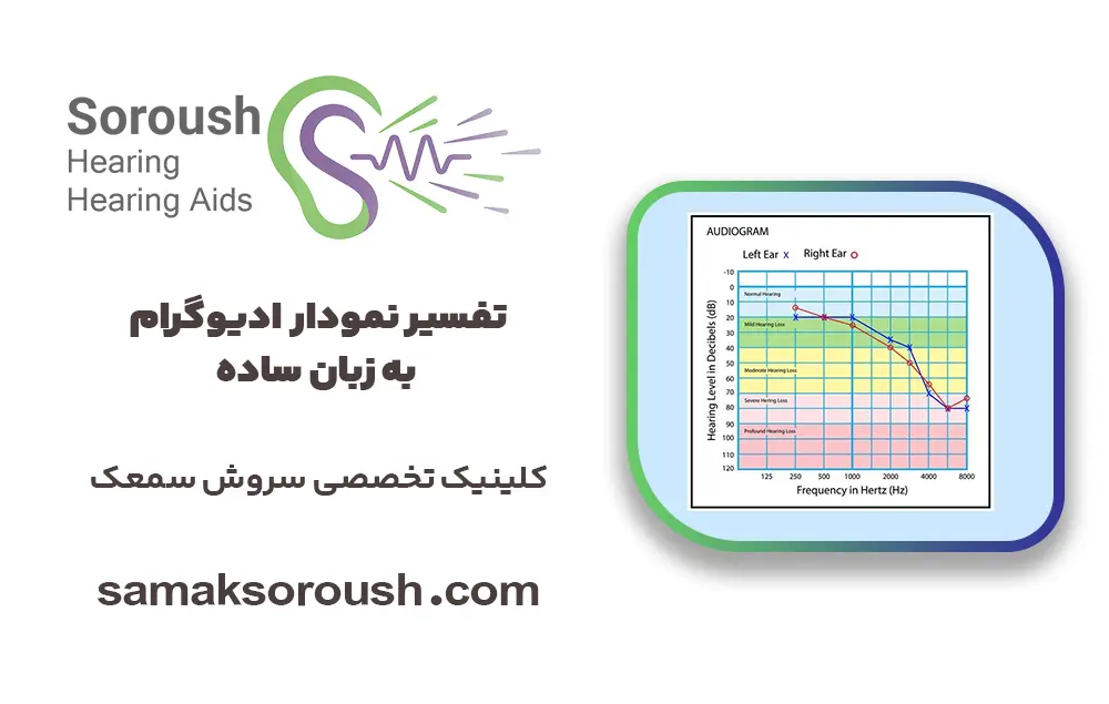 تفسیر نمودار ادیوگرام به زبان ساده