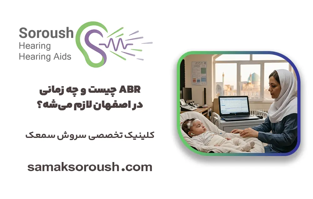 ABR چیست و چه زمانی در اصفهان لازم می‌شه؟