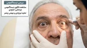 بررسی حرکات غیرارادی چشم یا نیستاگموس در تست سرگیجه وضعیتی